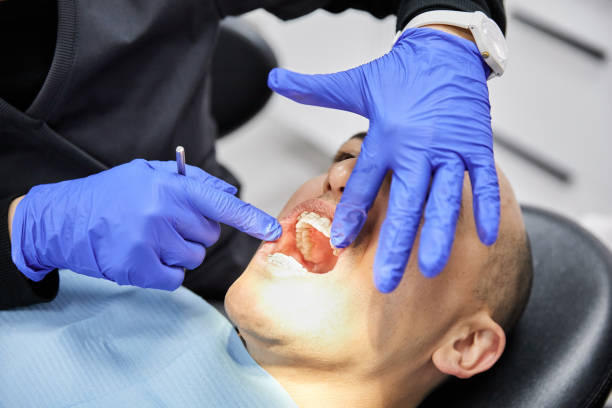 Best Emergency Tooth Extraction  in Alameda, CA